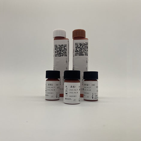 尿酸（UA）檢測(cè)試劑盒（酶法）